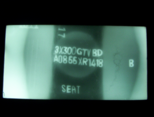 Radiograph 3